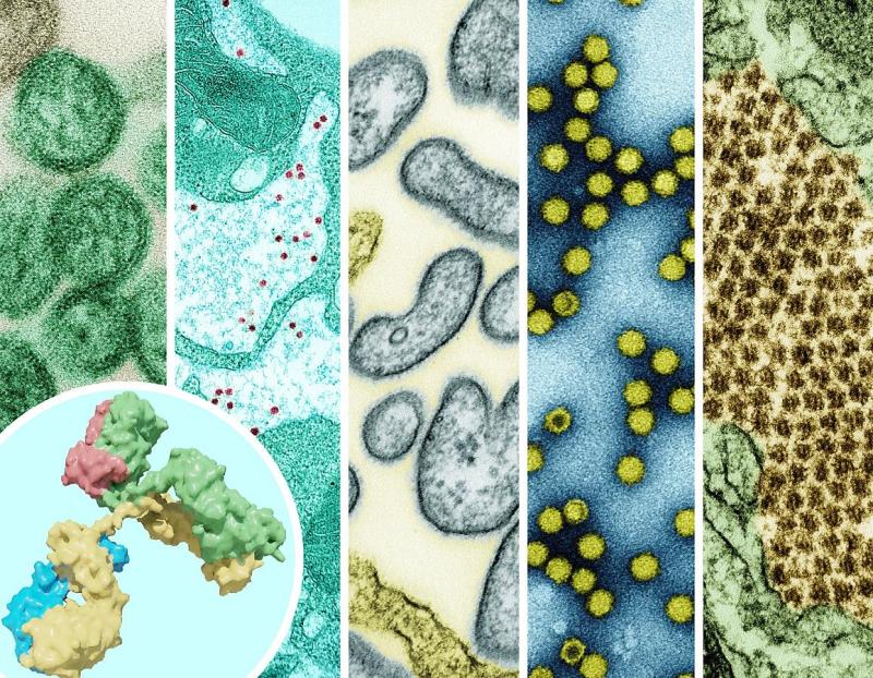 The ReVAMPP network will support monoclonal antibody and vaccine research on pathogens from many different groups of viruses, including those shown here: hantavirus, yellow fever virus, Nipah virus, picornavirus, and Chikungunya. NIAID