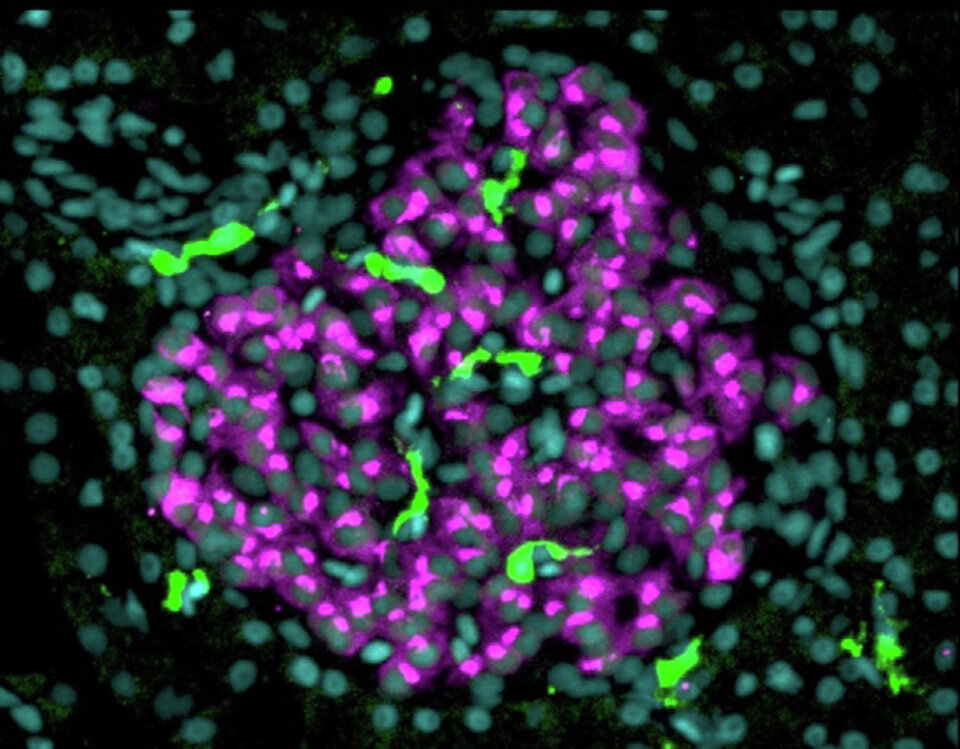 Mathematical Modeling of Beta Cell Turnover Reveals Non-Trivial Contributions of Apoptosis to Pancreas Development